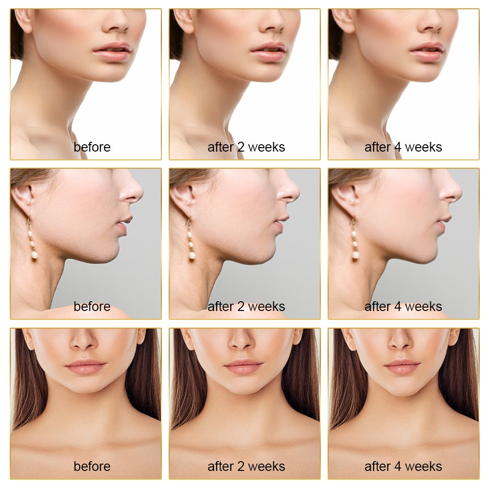 EMS Facial Lifting Massager